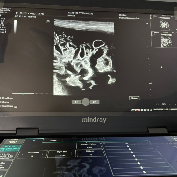 A ultrasound scan on screen